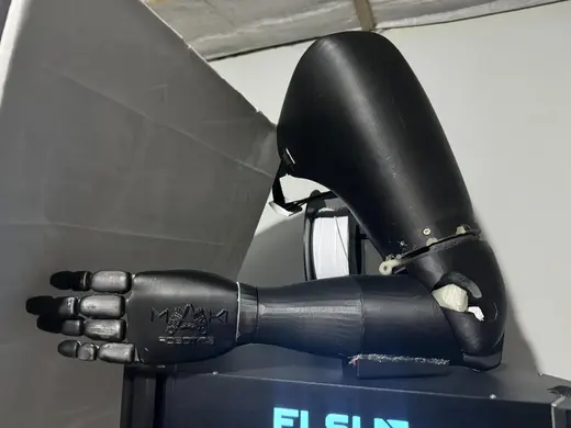 prótesis 3D con inteligencia artificial